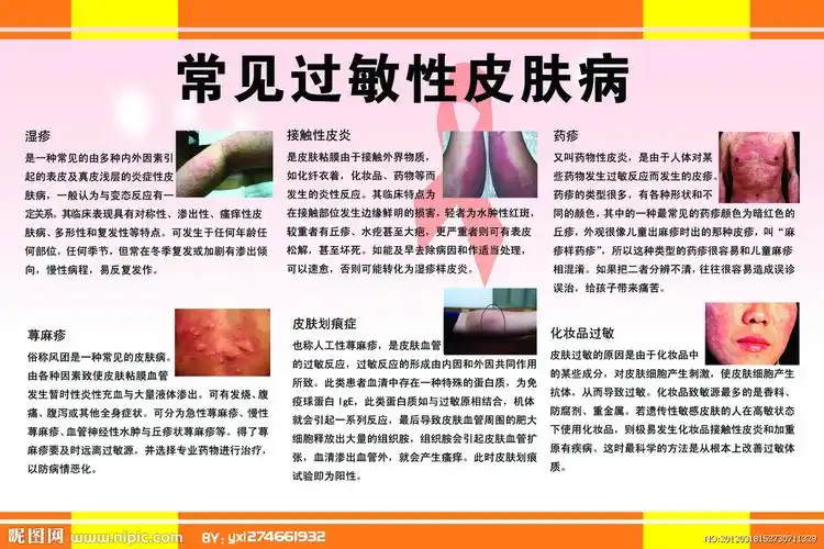 过敏源检查项目_皮肤过敏治疗_南昌中山皮肤病医院