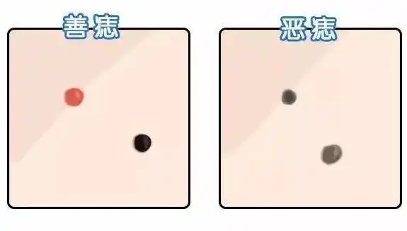 痣相看命运:手臂这处有痣的人,命中财运好,富贵双全家业旺