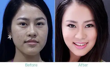 美白对比_百度图片搜索