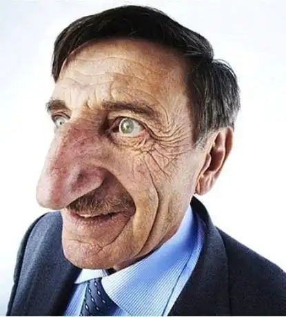 世界上鼻子最大的人