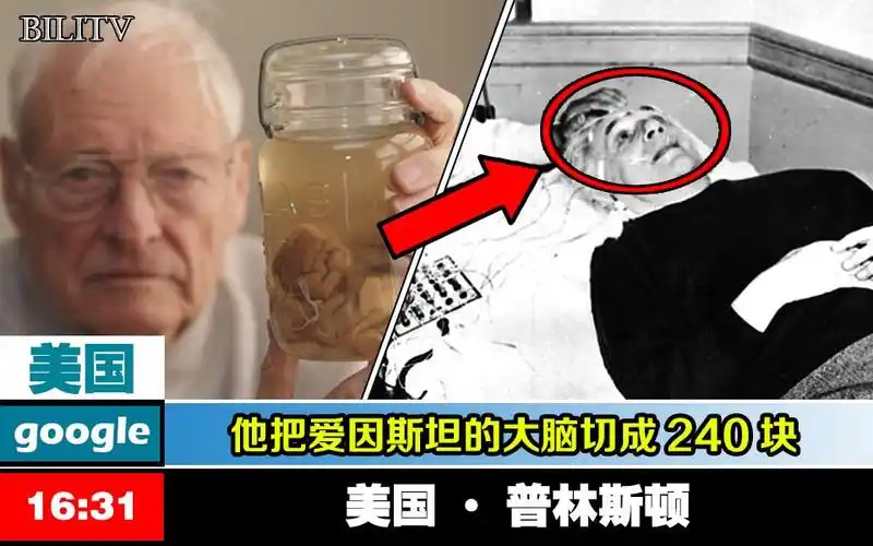 揭秘爱因斯坦大脑被偷走切成240块后发现惊人真相