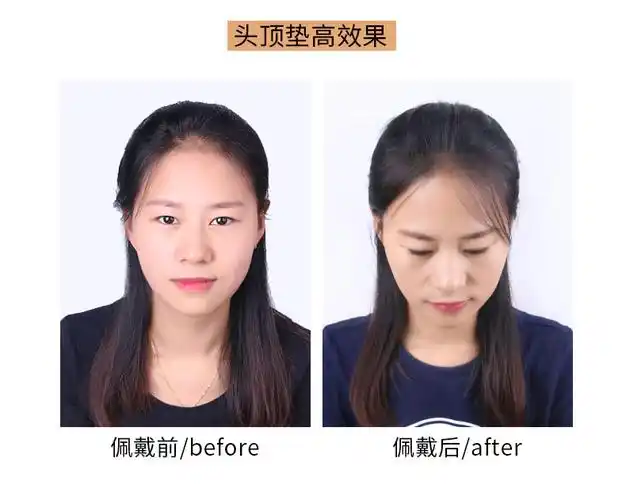 抖音网红垫发根蓬松器头顶补发内蓬垫发片无痕隐形空气刘海假发片25cm