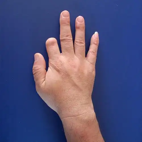 假肢手指假手指 指 断手指美容手指量身定做假脚趾假手指头 无名指