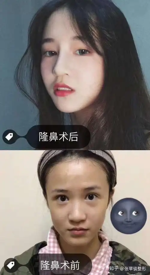 鼻梁的高低带给你颜值的差距有多大