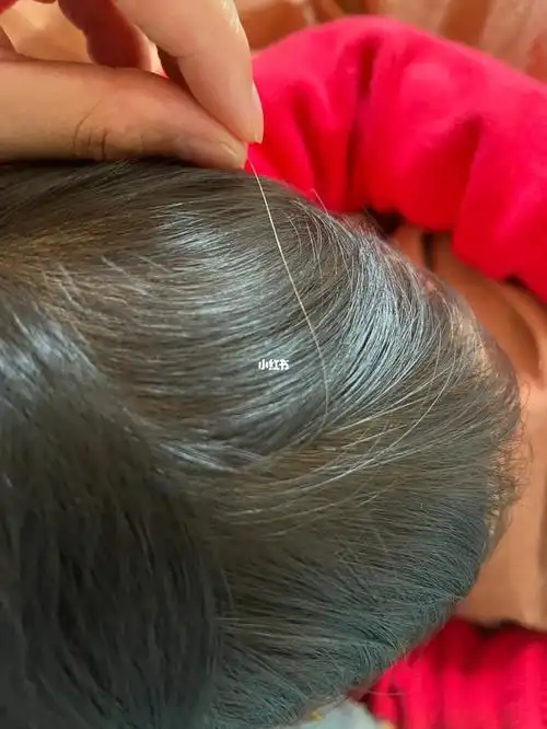谁能解答小宝宝惊现一根白头发