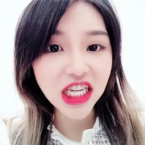 感觉小的时候看着自己外翻的虎牙还蛮可爱的,长大以后_圈子-新氧美容