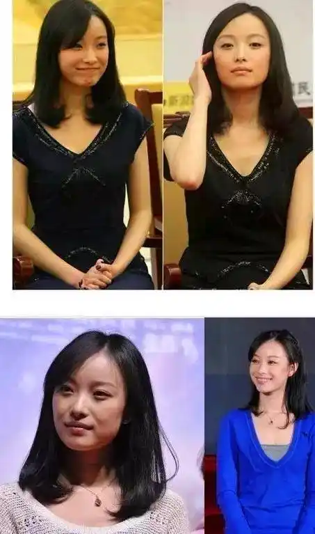 倪妮大量罕见童年照曝光,在公园表演一字马撞脸杨幂,整没整容一清二楚