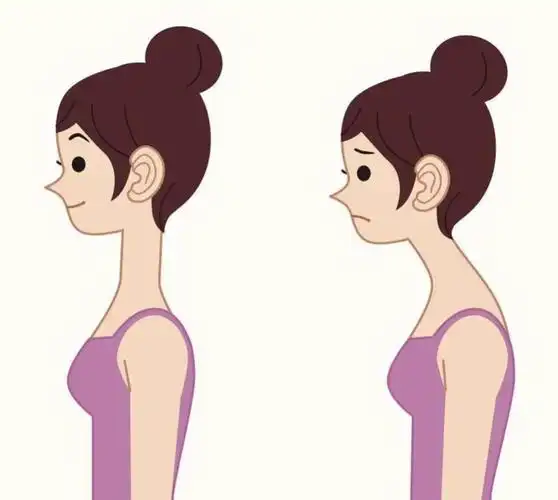 三分钟带您了解脖子前倾