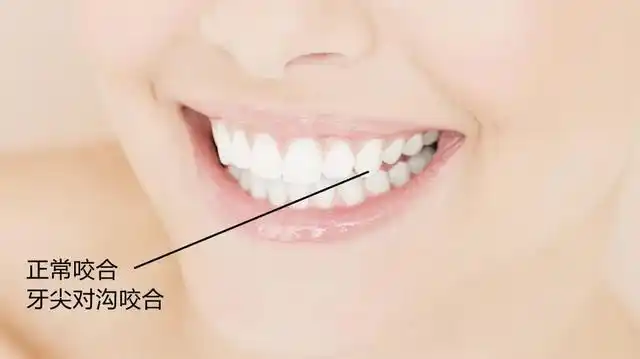 如何理解牙齿咬合不正正畸前须知