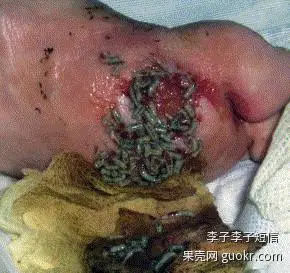 蛆虫疗法的清理速度