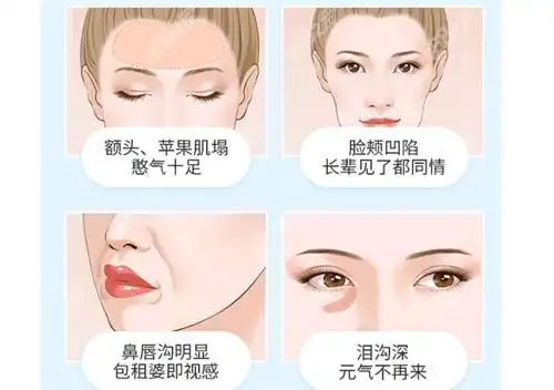 附做脂肪填充技术好的医院,口唇对比照-8682赴韩整形网