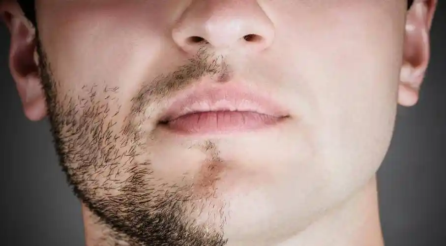 男人胡子长得快,说明什么?刮胡子频率高寿命短?医生告诉你真相