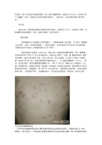 小儿各类皮肤病及图片.docx