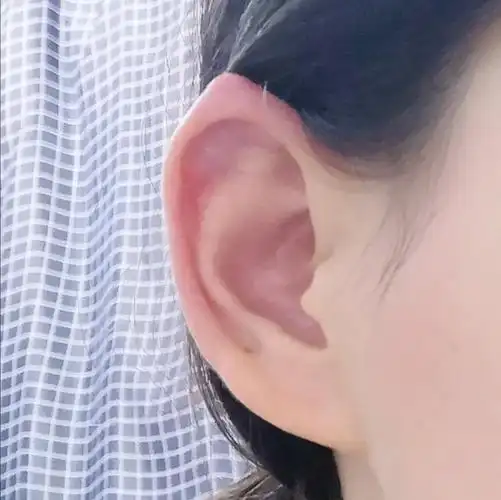 大家身边有尖耳朵的人吗