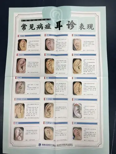 诊病挂图 中医望诊系列挂图 2开高清挂图 图解耳诊书籍 中医常见病症