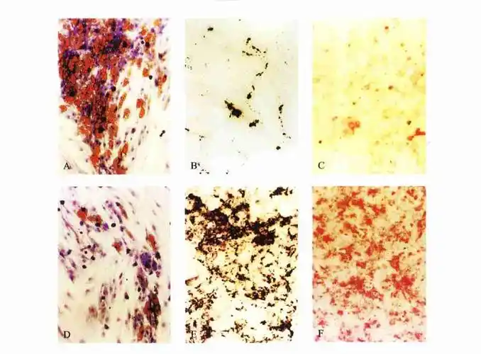 木质化细胞长什么样?(想要图图!