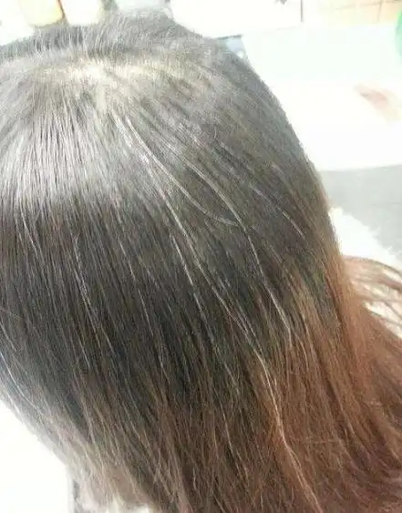 当然了,这个方法是适用于血热性的白发的,如果你的白头发是因为压力太