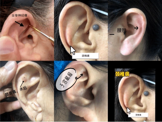 观耳识疾病贴耳促健康