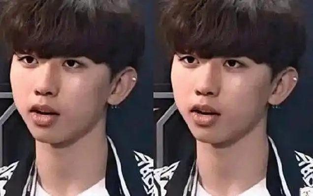 从这张照片中就可以看到,以前的蔡徐坤皮肤黝黑,而且脸上还有很多的