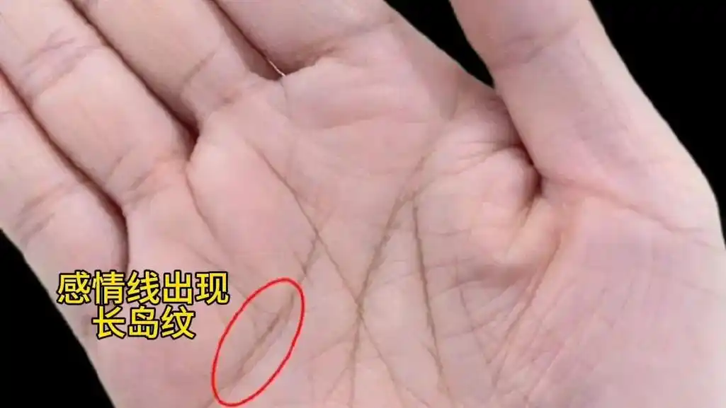 感情线上出现岛纹,非常常见.常见的,是岛纹出现在无名指下方 - 抖音