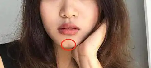 沟是指在下巴的中间有一条浅浅的沟,在西方又叫欧米伽型下巴(w型下巴)