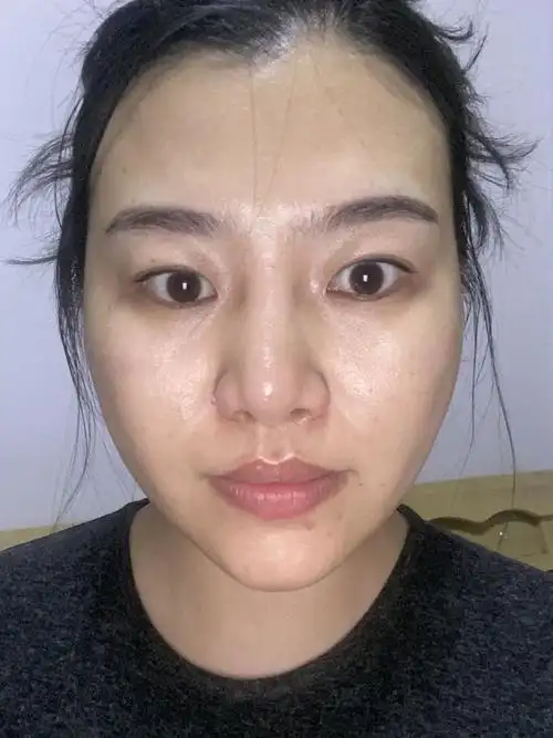 苹果原相机拍出来脸是歪的侧面脸扁平想知道自己需要改哪方面最近有想