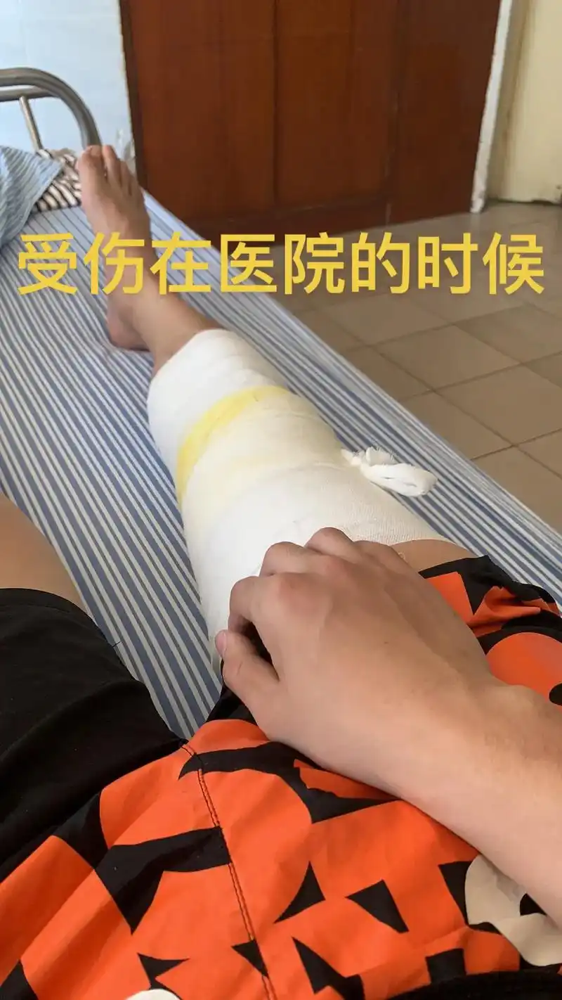 恢复一年多的历程.2020年受伤,图一就是当时意外伤到了脚自 - 抖音
