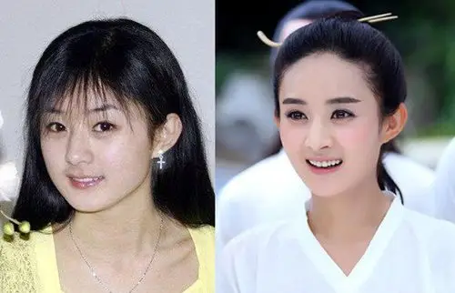 赵丽颖整容前后照片曝光 包子妹以前的脸更圆!