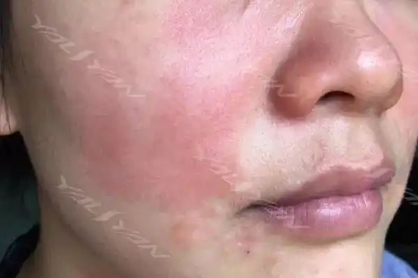 角质层受损并不是一朝一夕就能                    我们日常的护肤