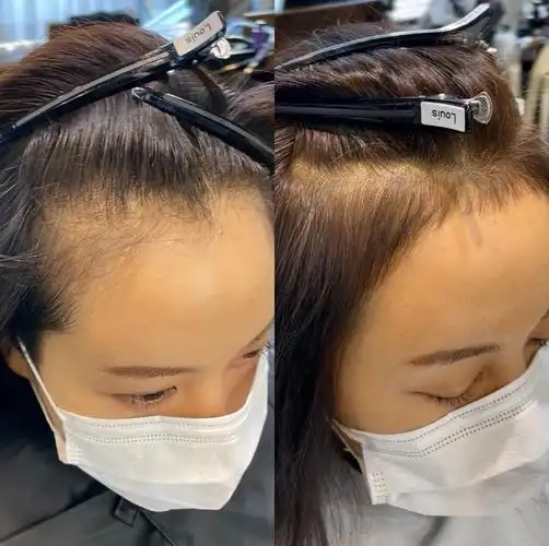 高额头m型发际线的mm看过来