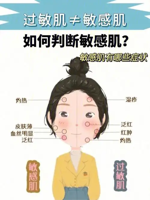 如何判断敏感肌