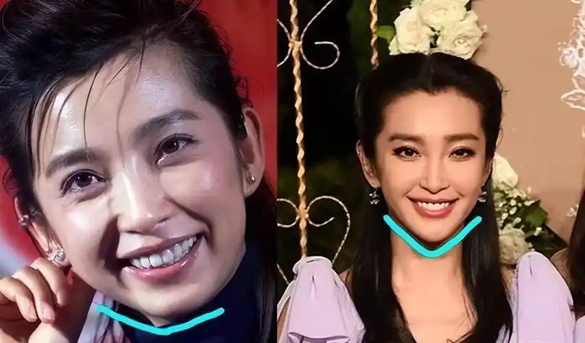 李冰冰,杨幂削骨后遗症或许非常明显了_状态_手术_下巴