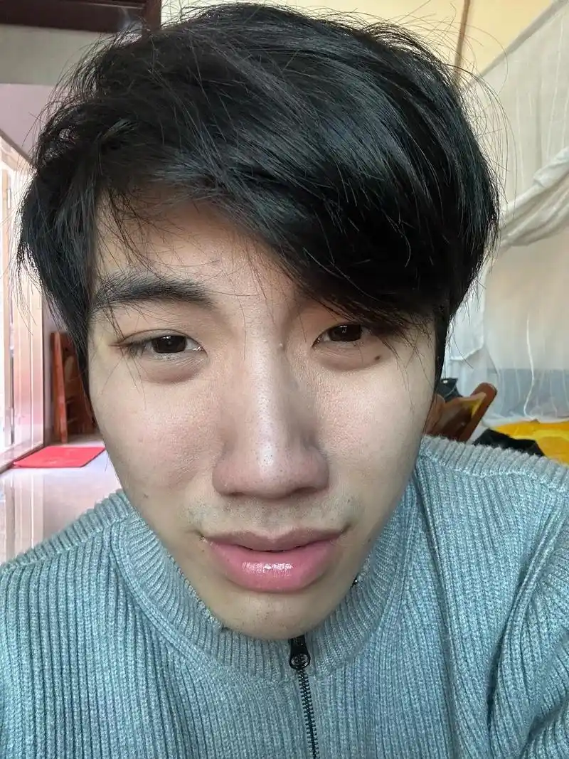 男生五官精致不一定有皮肤干净重要.#反差 #逆袭 #192  - 抖音