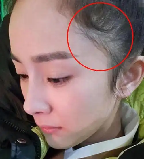 杨幂baby发际线堪忧女明星生完孩子后的通病再难回到少女时期