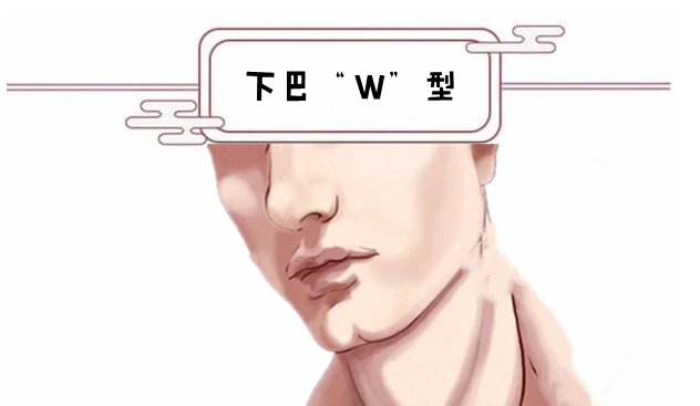 下巴"w"型