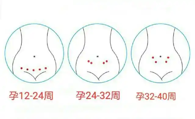 其实这种情况大多数是因为孕妈咪没有找到胎心位置导致的.