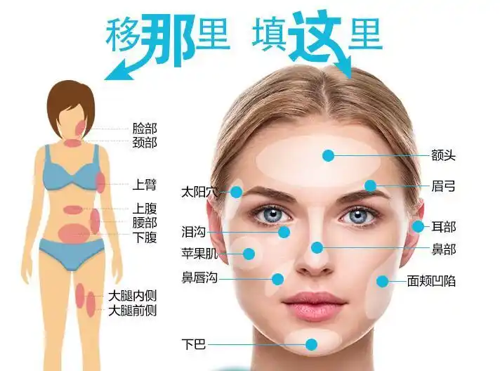 面部脂肪填充效果怎么样有什么后遗症