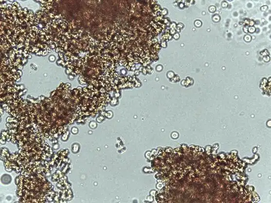 交叉配血中常见的凝集反应