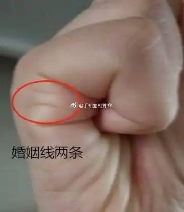 1,有三条婚姻线 有些人天生感情线就比别人复杂,手掌上会出现三条婚姻