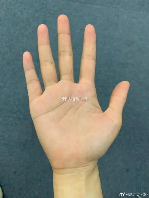 孩子,生命线断开乃手相中的大忌!你要多保. 来自相命禅师 - 微博