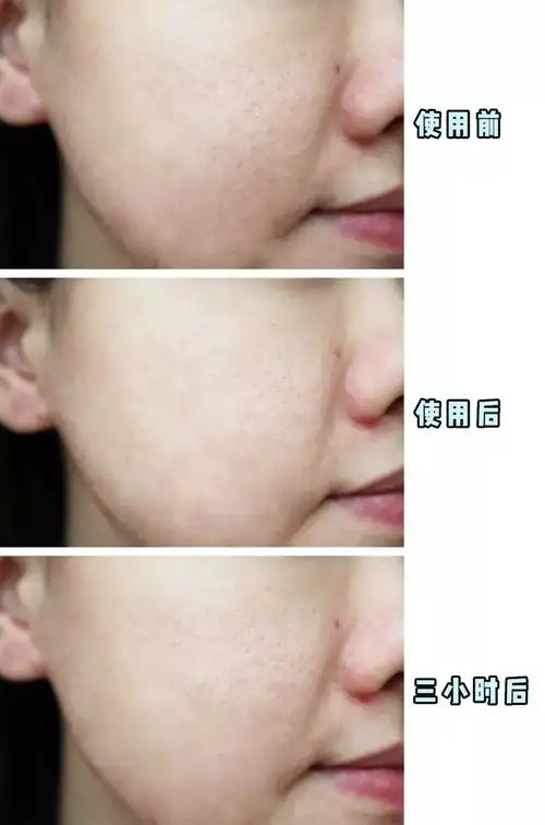 冰凉夏日美白策略!要水光不要油光!