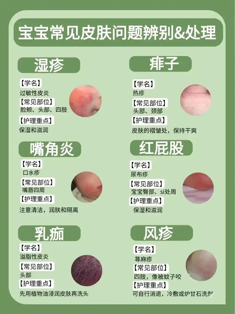 宝宝常见皮肤问题辨别和处理办法,无论是哪种皮肤问题