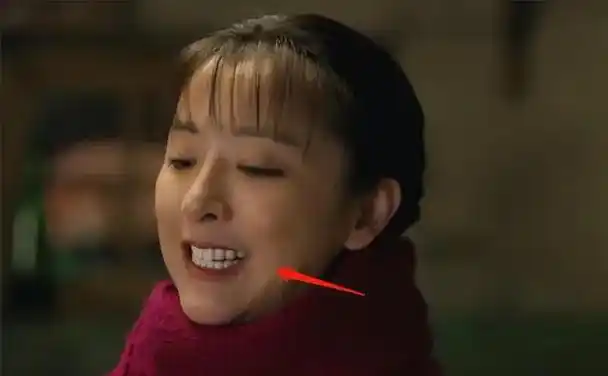 "烤瓷牙"上镜有多拉垮?嘴凸包不住,牙比灯还亮,演戏都没法看