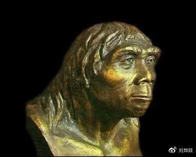 手术示意图 ④眉下切,眉毛和眼睛间的距离过近,会有原始人的感觉,眉下