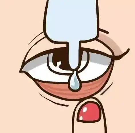 眼药水不能滴在黑眼珠上,而是要扳开下眼睑,把眼药水滴在眼睛下方的