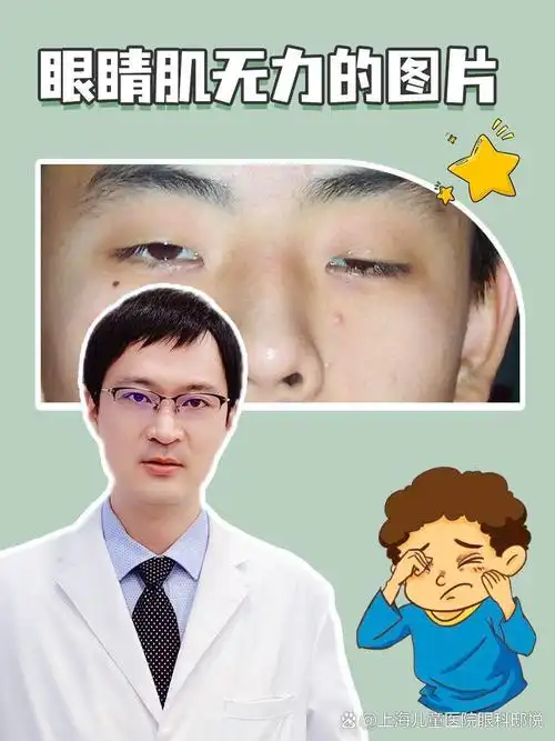 眼睛肌无力是一种常见的眼部疾病,主要影响眼部