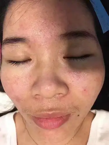 专业修复问题性皮肤,还你美丽容颜.