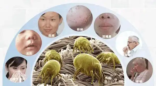 白糖放久了会滋生螨虫?还会导致这些病?