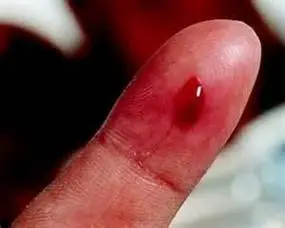 伤口流血简笔画 第5页