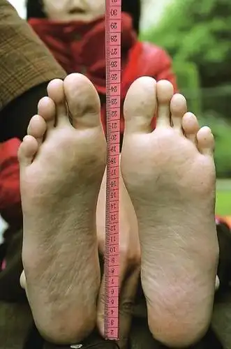 福州12岁女孩长巨脚 43码鞋还穿不下_新闻台_中国网络电视台